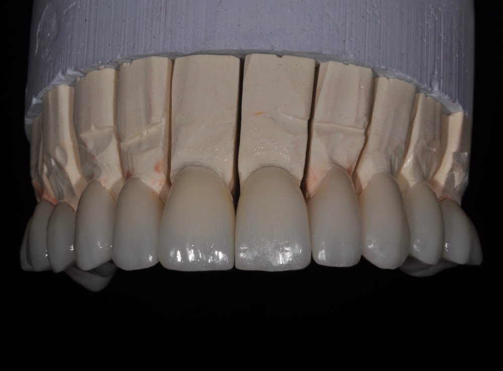 Restorative Dental Ceramics, Inc.
